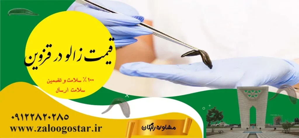 خرید زالو در قزوین