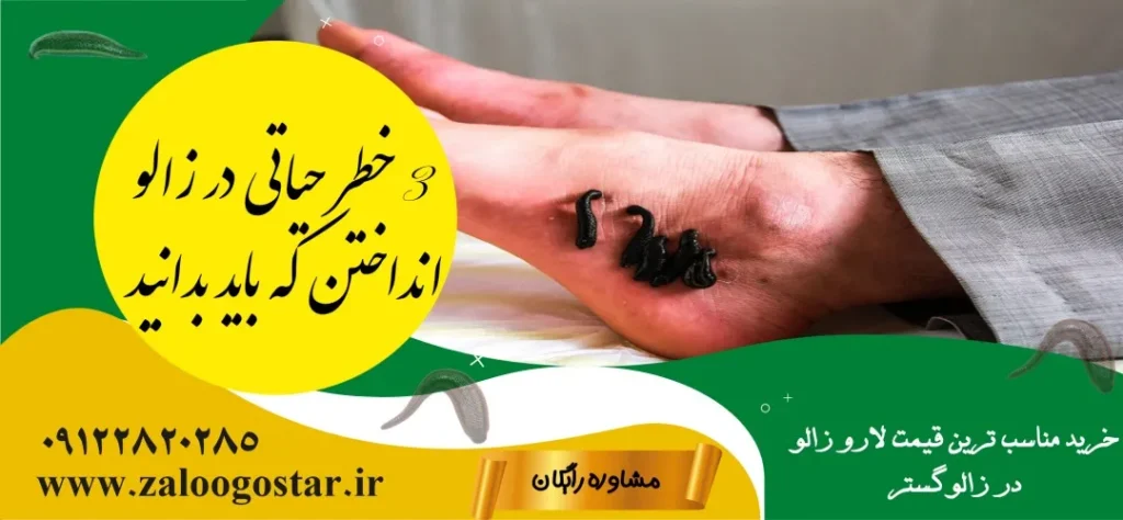 بهترین جای بدن برای زالو انداختن+3خطر حیاتی