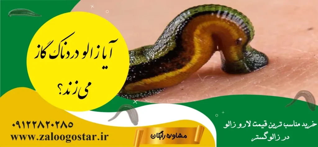 زالو چند تا دندان دارد