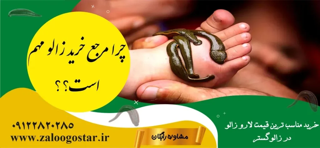 از کجا میشه زالو خرید