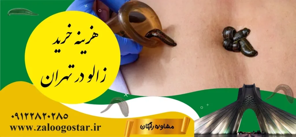 هزینه خرید زالو در تهران