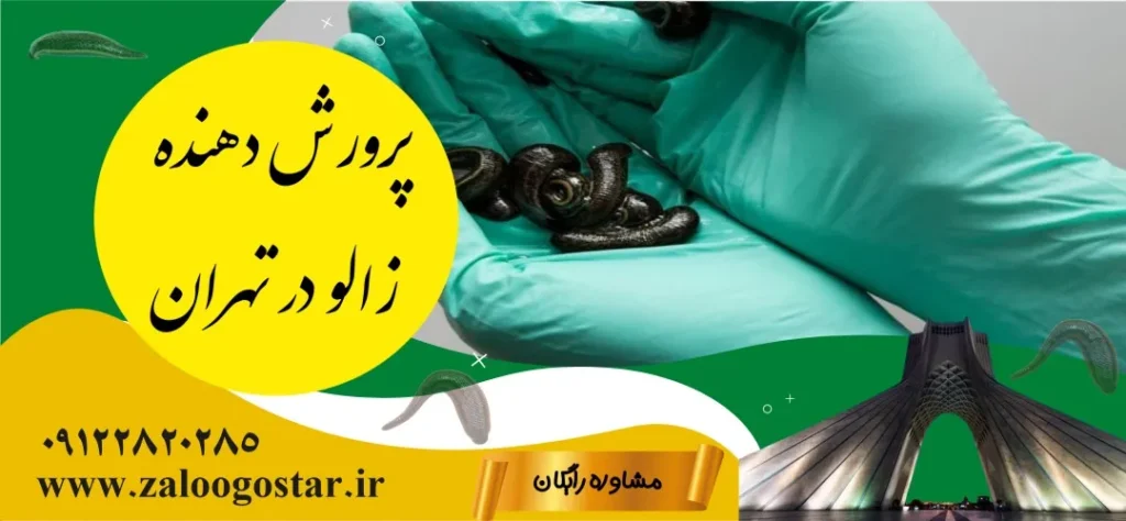 پرورش دهنده زالو در تهران