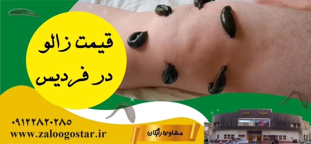 خرید زالو در فردیس