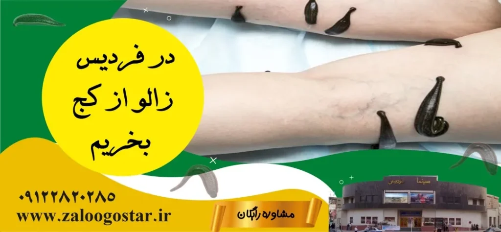 خرید زالو در فردیس