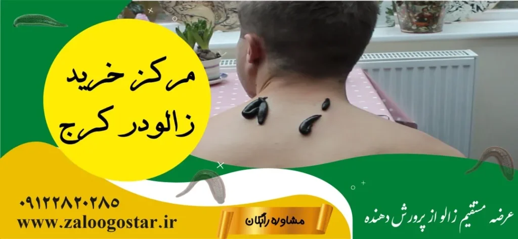 خرید زالو در کرج