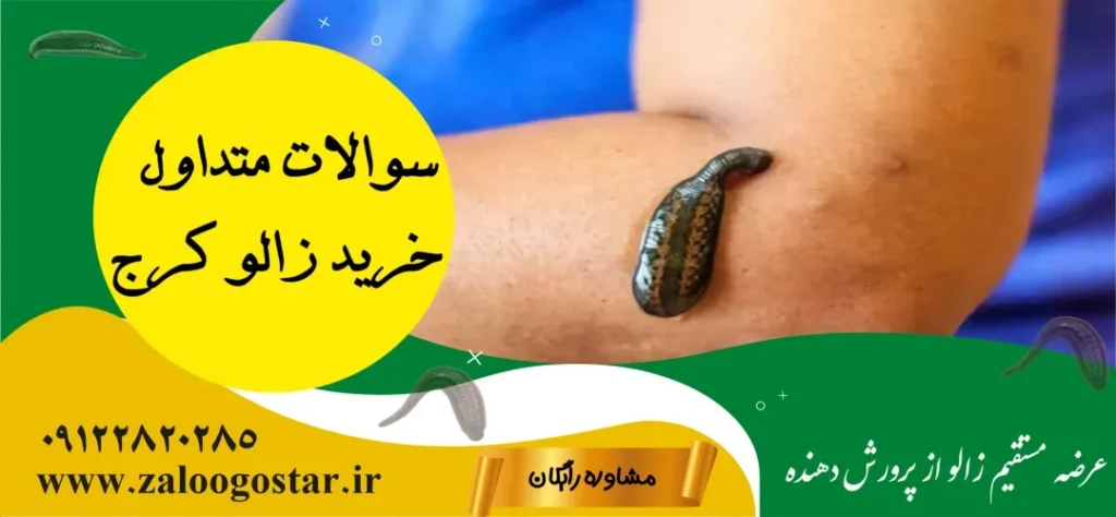 خرید زالو در کرج