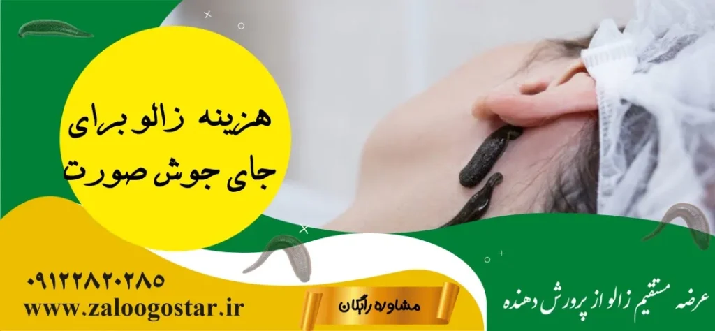 هزینه درمان با زالو برای جوش صورت چقدر