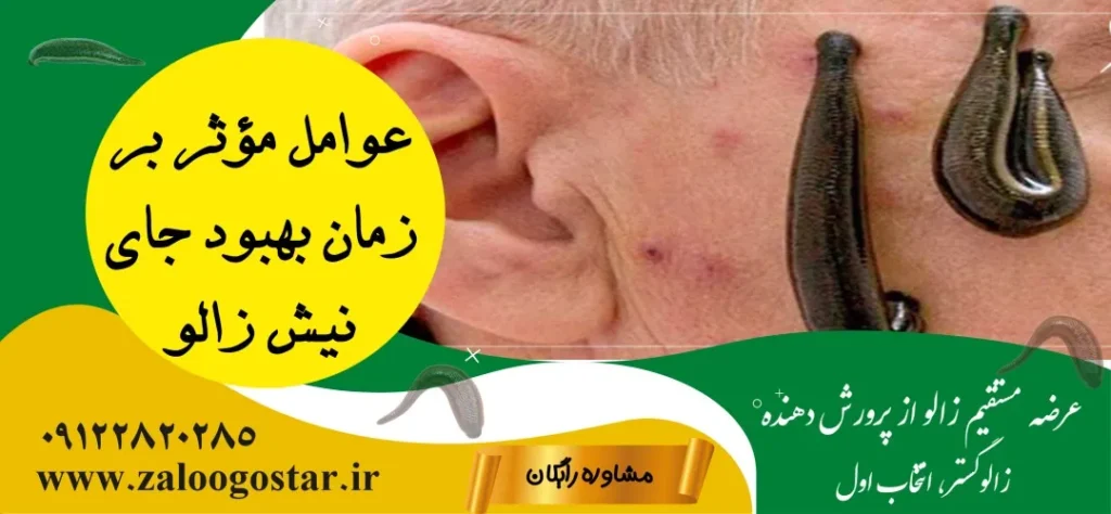 جای زالو کی خوب میشه