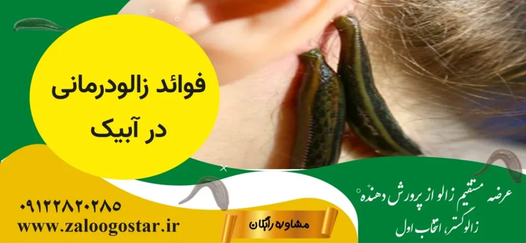 خرید زالو در آبیک |زالودرمانی در آبیک