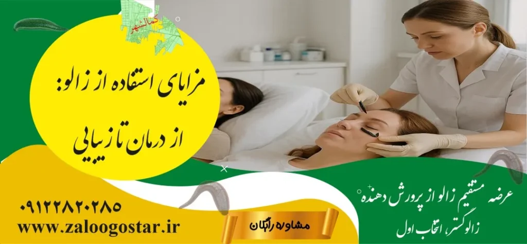 خرید زالو در کمالشهر