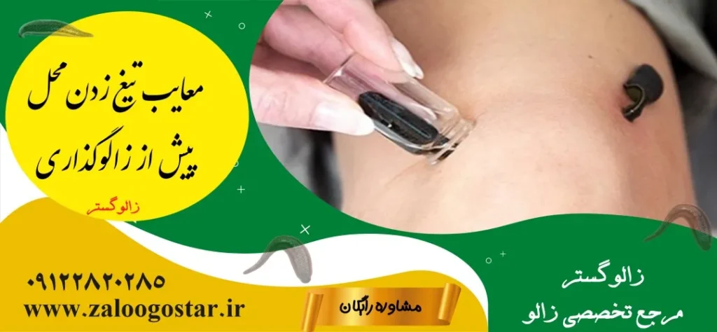 تیغ زدن محل قبل از زالو درمانی درست است؟