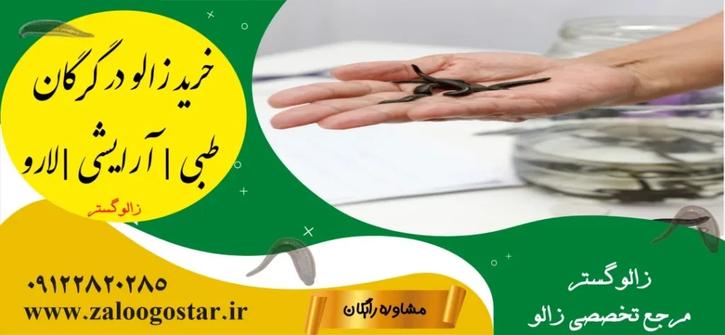 خرید زالو در گرگان