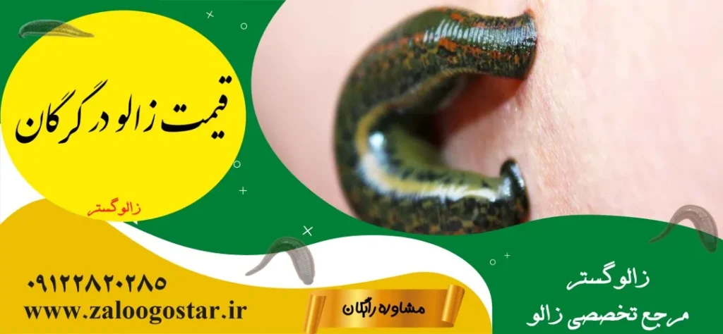 خرید زالو در گرگان