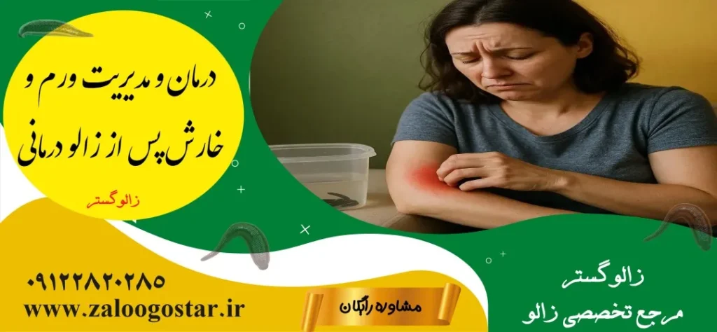 علت ورم و خارش بعد از زالو درمانی