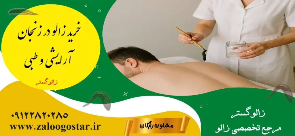 خرید زالو در زنجان