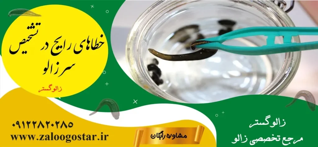 سر زالو کدام طرف است