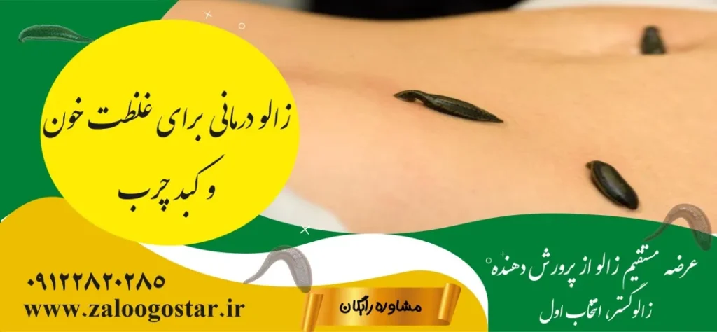 زالو درمانی برای غلظت خون و کبد چرب: از سیر تا پیاز درمان