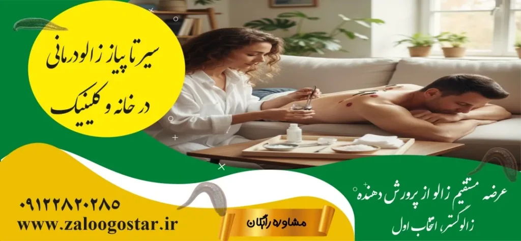 زالودرمانی در خانه