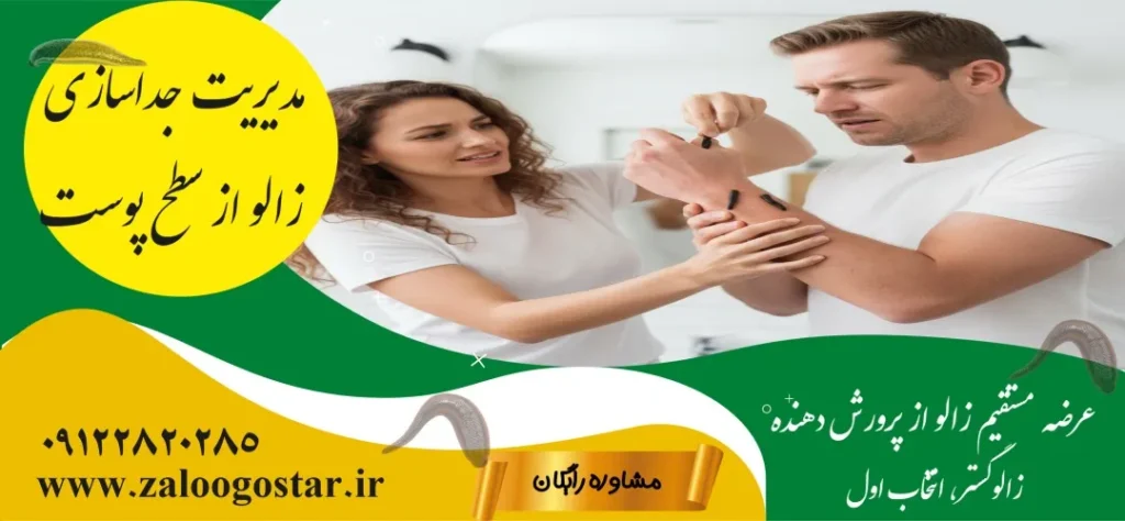 زالودرمانی در منزل