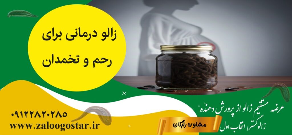 زالو درمانی برای رحم و تخمدان