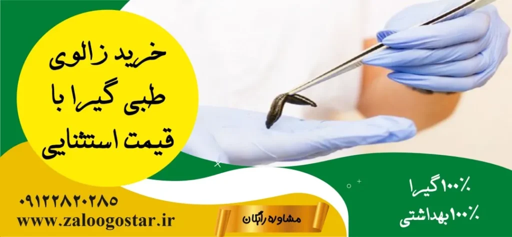 خرید زالوی طبی