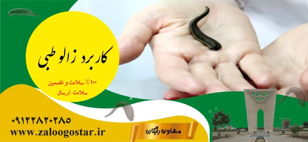 خرید زالو در قزوین
