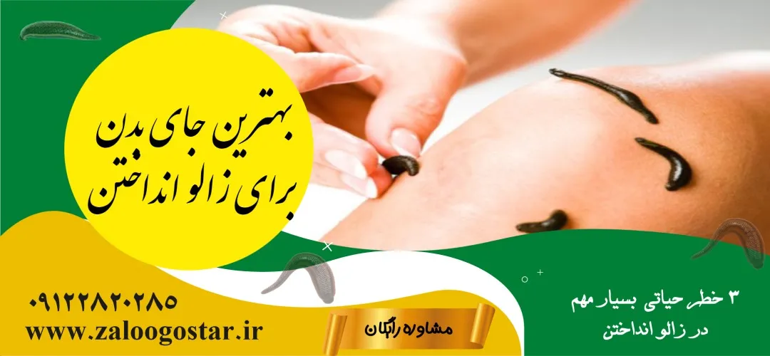 بهترین جای بدن برای زالو انداختن+3خطر حیاتی