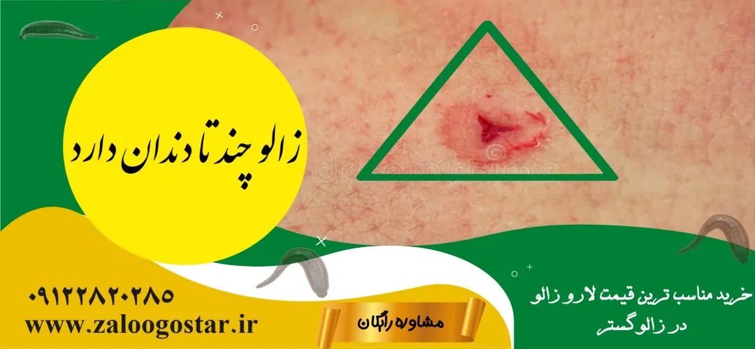 زالو چند تا دندان دارد