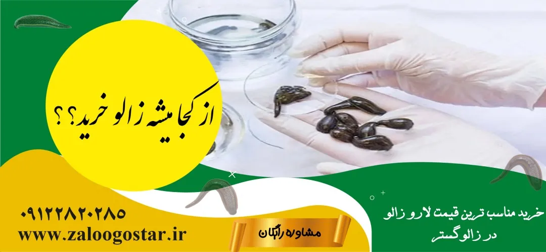 از کجا میشه زالو خرید