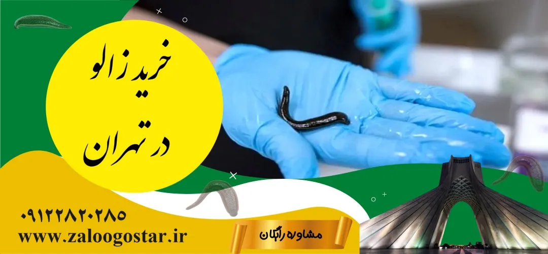 خرید زالو در تهران