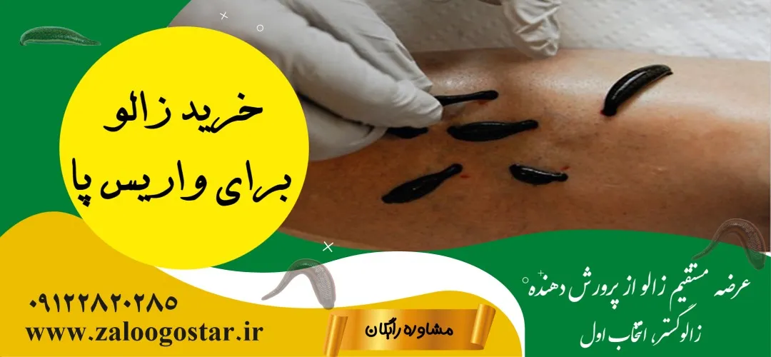 خرید زالو برای واریس پا