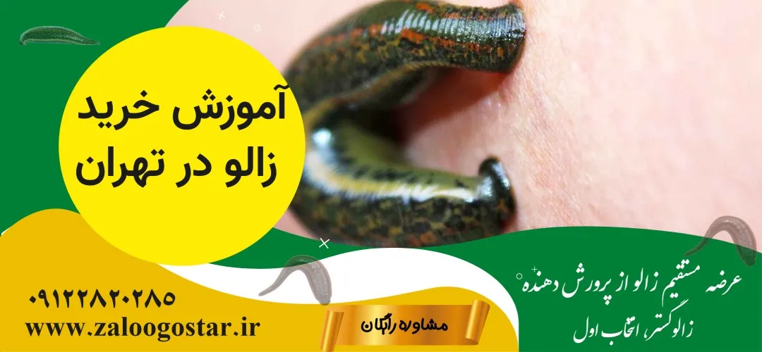 آموزش خرید زالو در تهران