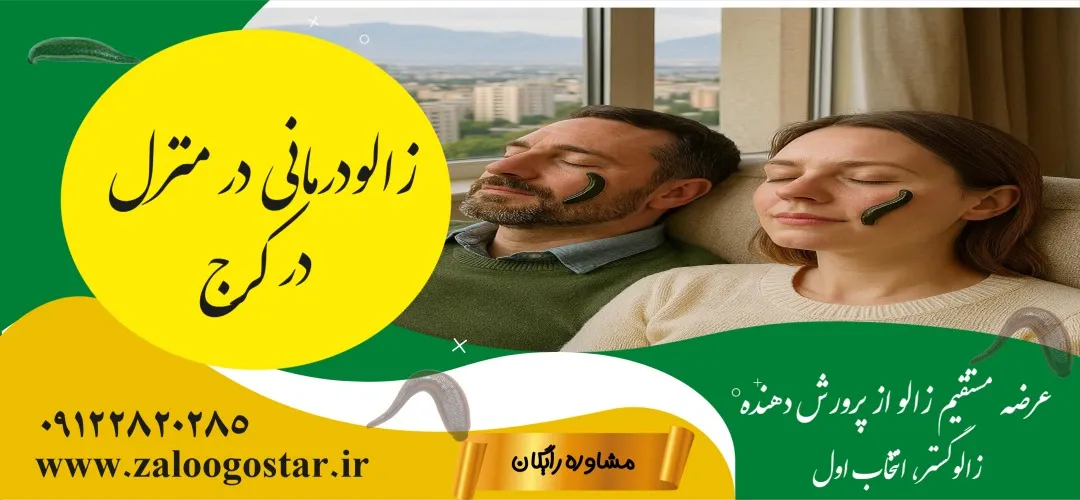 خرید زالو برای زالودرمانی در خانه در کرج