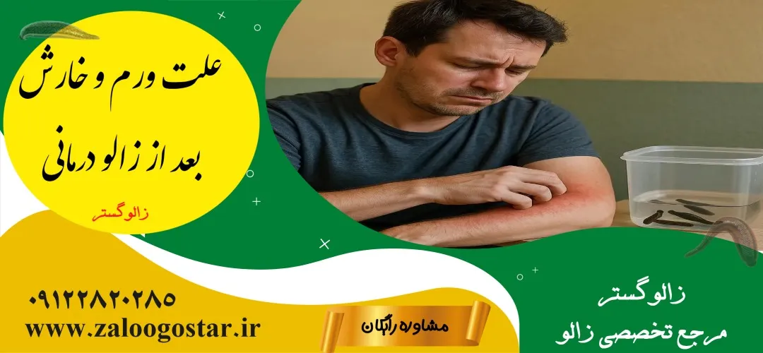 علت ورم و خارش بعد از زالو درمانی