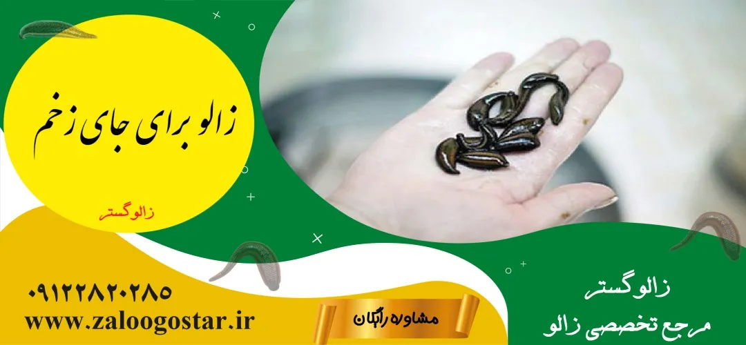 زالو برای جای زخم