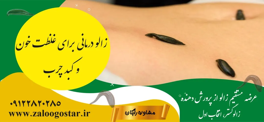 زالو درمانی برای غلظت خون و کبد چرب: از سیر تا پیاز درمان